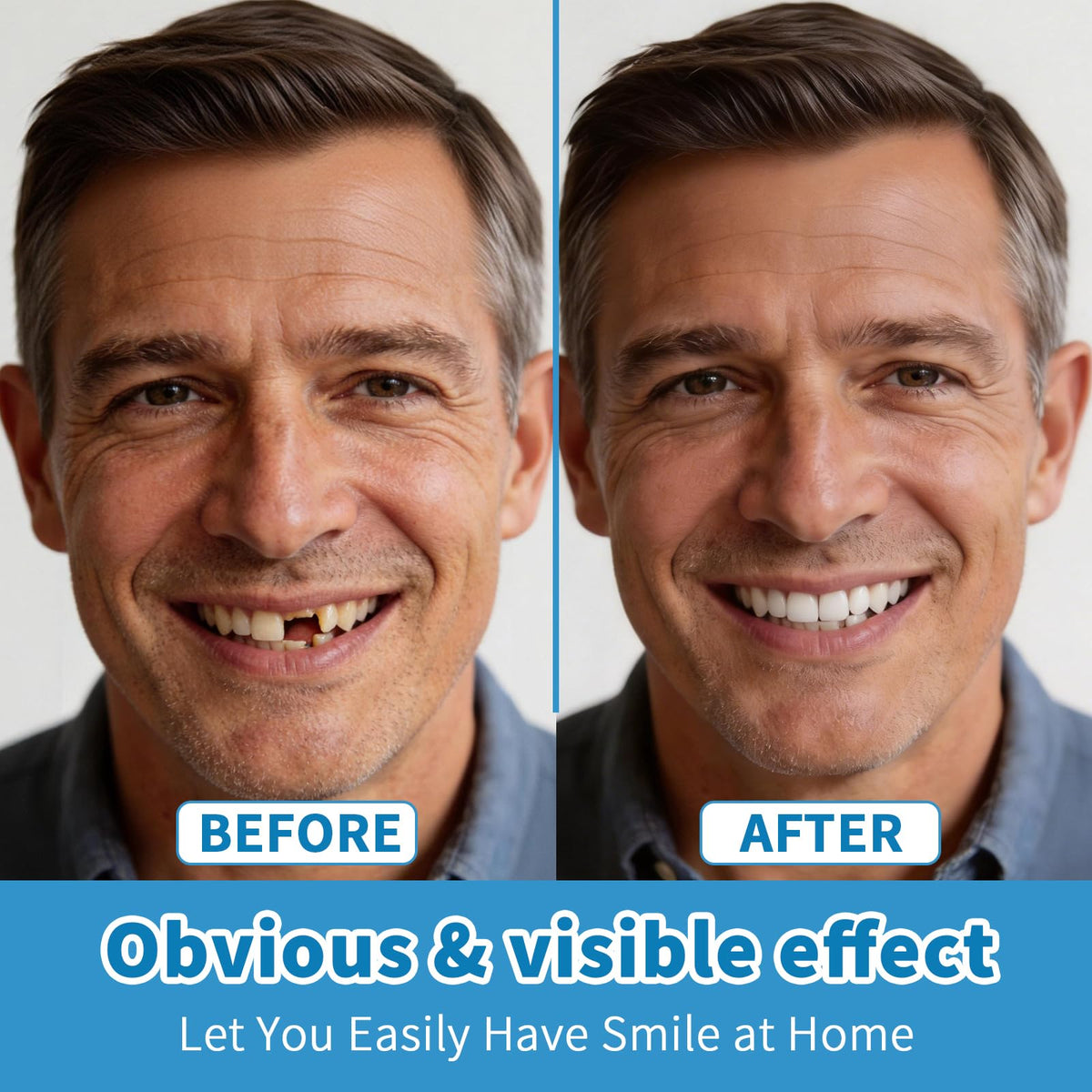 Silicone Denture Set Upper Lower Full Teeth I24882